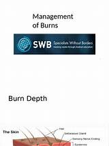 Strickler Burn Notice: a Comprehensive Guide to Understanding the Phenomenon