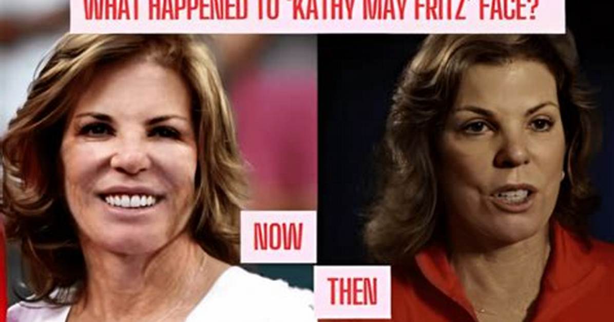 Taylor Fritz S Mother Stuns with Face Surgery
