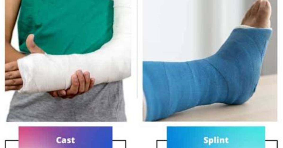 The Difference Between Cast