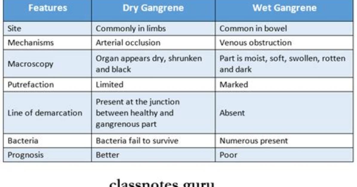 The Differences Between Dry