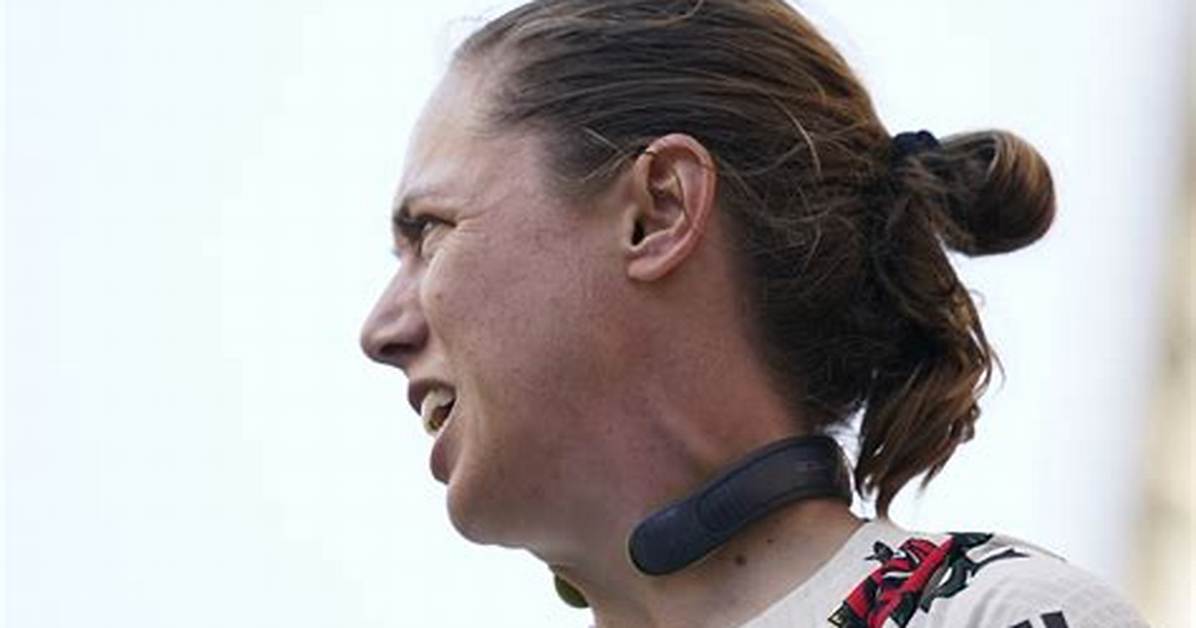 The Intriguing World of Necks Individuals with Extraordinary Cervical