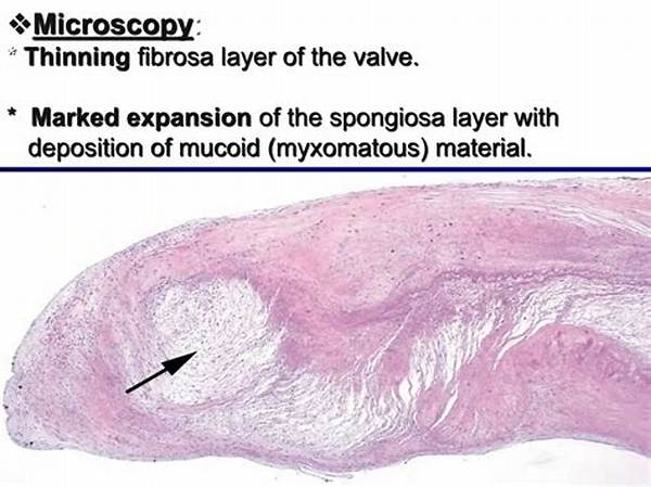 The Perils of Myxomatous Valve Disease: a Comprehensive Guide