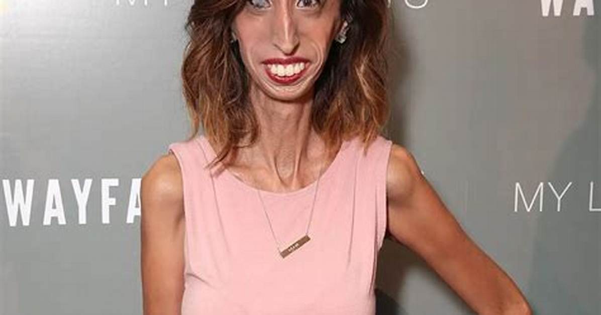 The Skinniest Person