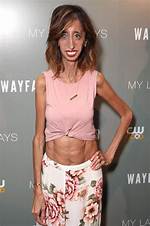 The Skinniest Person