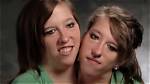 The Tragic Fate of Conjoined Twins: Abby and Brittany Hensel