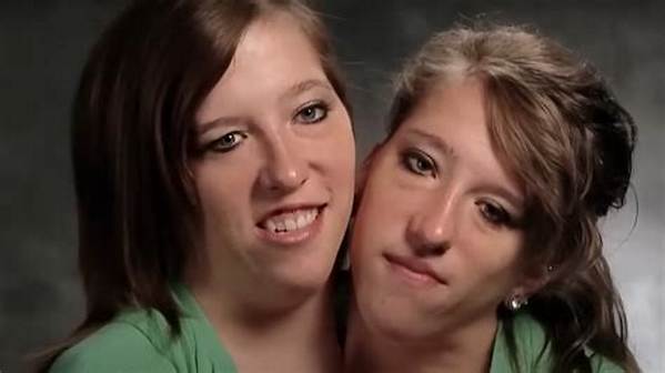 The Tragic Fate of Conjoined Twins: Abby and Brittany Hensel