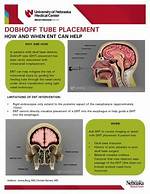 The Ultimate Guide to Dobhoff Tube Placement: Benefits, Procedure, and Aftercare