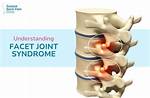 The Ultimate Guide to Facet Arthropathy: Definition and More