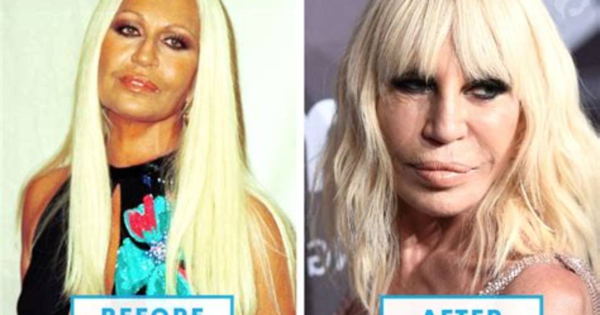 Top 9 Terribly Failed Celebrity Plastic Surgeries