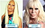 Top 9 Terribly Failed Celebrity Plastic Surgeries