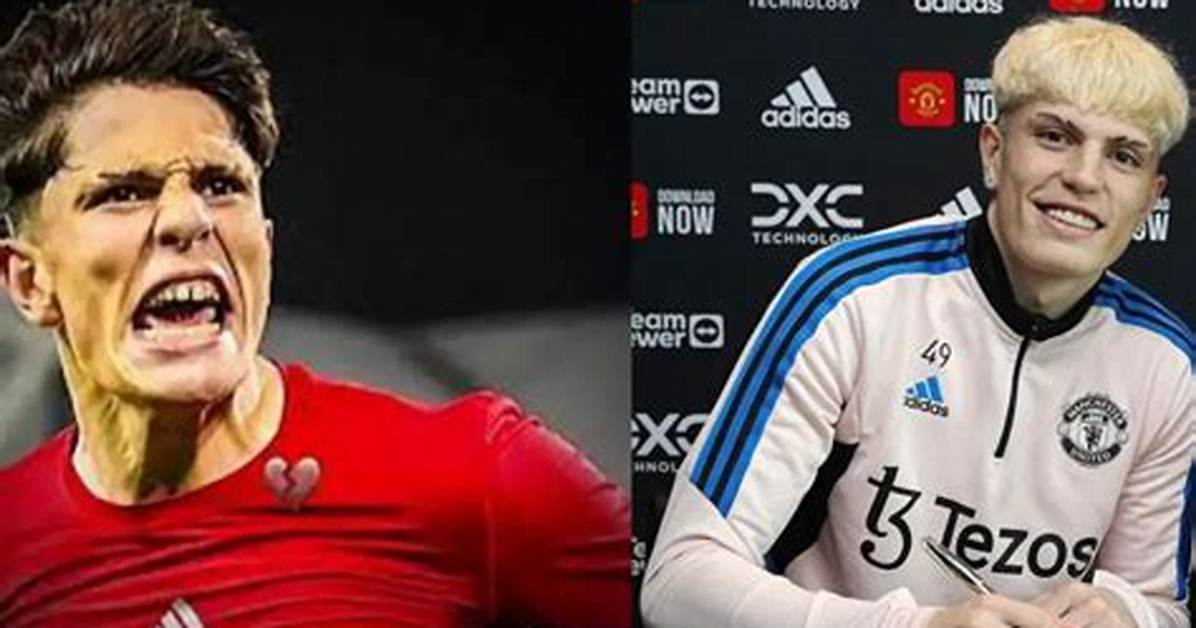 Top Garnacho Face Surgery Before and After