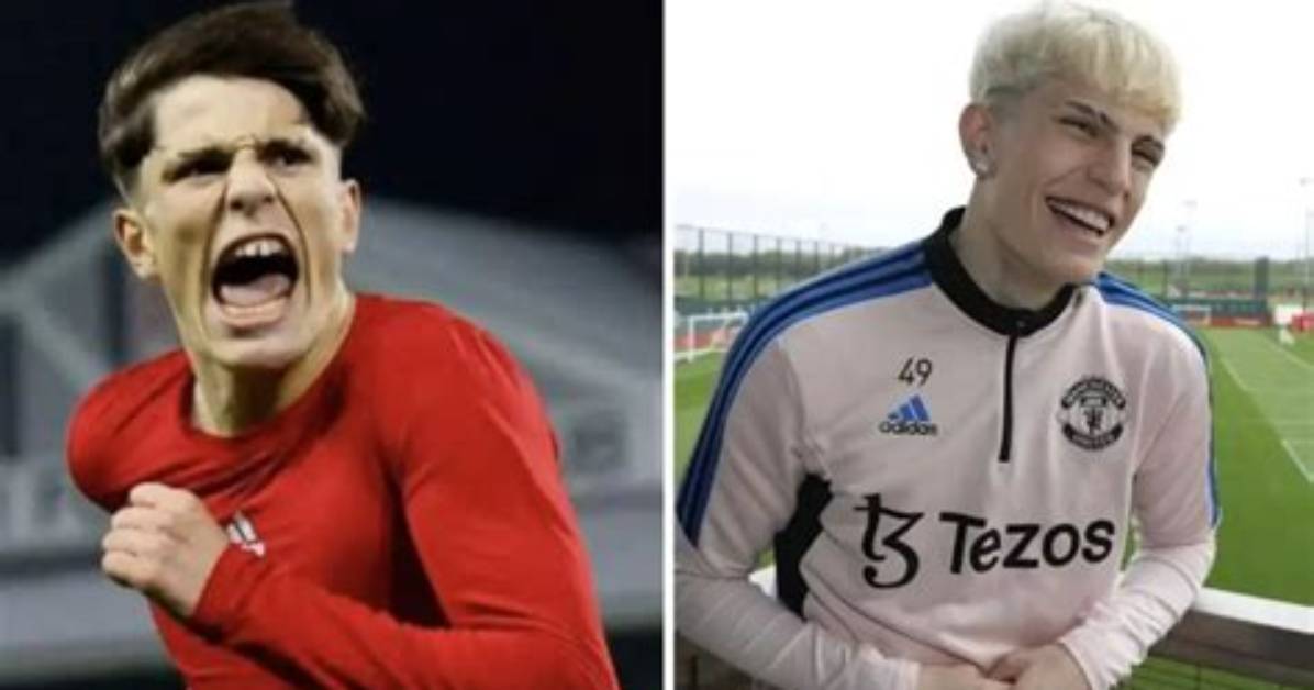 Top Garnacho Face Surgery Before And