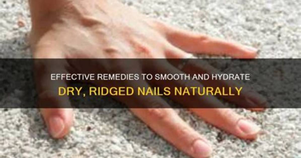 Treatment for Dry Nails with Ridges: a Comprehensive Guide to Restore Your Nail Health