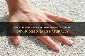 Treatment for Dry Nails with Ridges: a Comprehensive Guide to Restore Your Nail Health