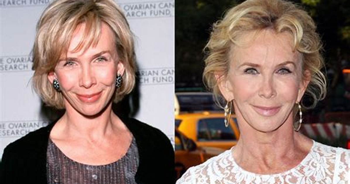 Trudie Styler: Before and After Plastic Surgery – a Comprehensive Exploration