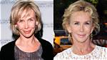 Trudie Styler: Before and After Plastic Surgery – a Comprehensive Exploration