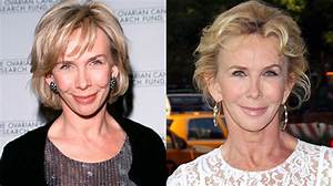 Trudie Styler: Before and After Plastic Surgery – a Comprehensive Exploration