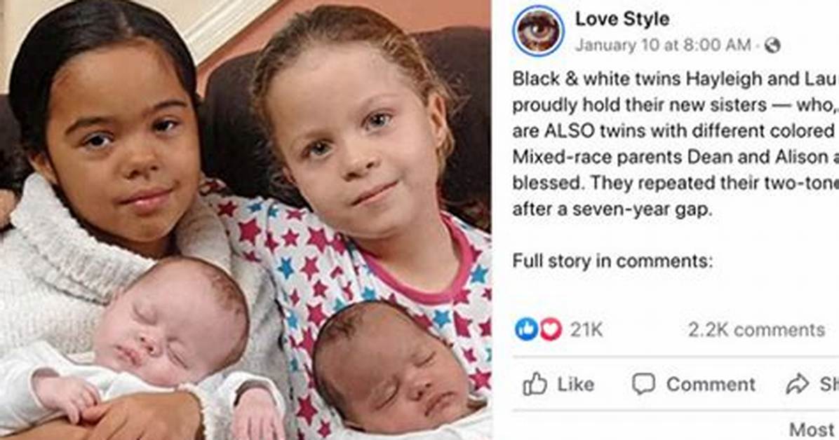 Twins Where One Is White and One Is Black