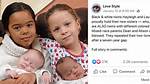 Twins Where One Is White and One Is Black