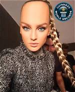 Unbelievable! Biggest Forehead in the World Revealed!