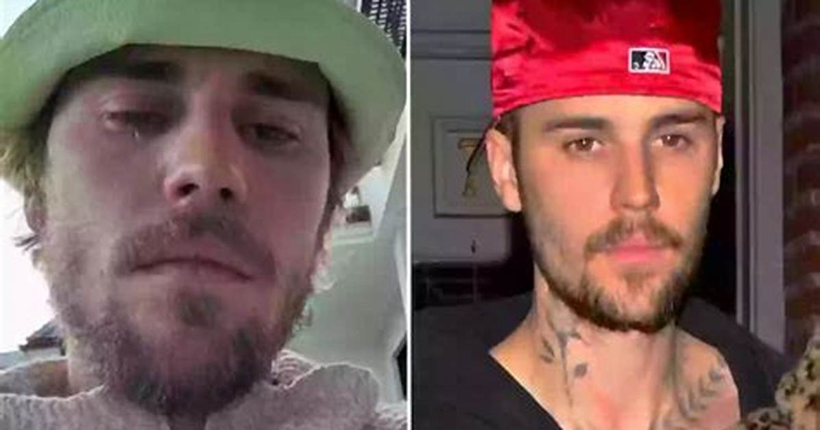 Uncovering Justin Bieber S Drug Use in 2024 a Shocking