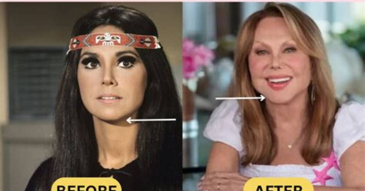 Uncovering Marlo Thomas S Surgeries a Comprehensive