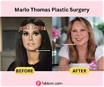 Uncovering Marlo Thomas's Surgeries: a Comprehensive Guide