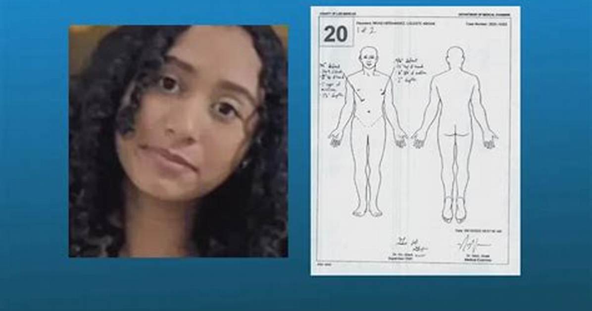 Uncovering the Truth Autopsy Results of Deceased Hip Hop