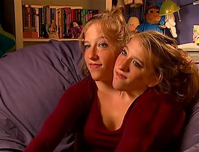 Understanding Abby and Brittany Hensel: the Remarkable Journey of Conjoined Twins