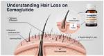 Understanding Hair Loss Due to Semaglutide: Causes, Solutions, and Prevention