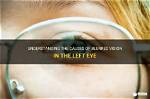 Understanding Left Eye Vision: Insights, Causes, and Solutions