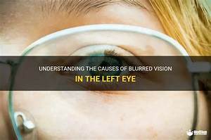 Understanding Left Eye Vision: Insights, Causes, and Solutions