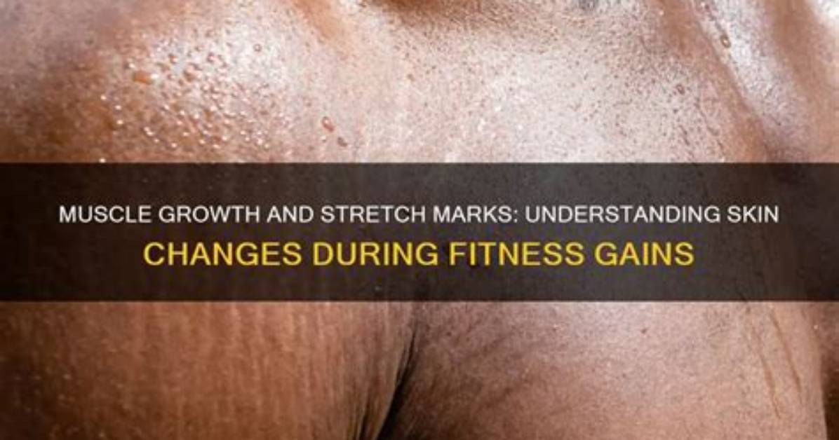 Understanding Stretch Marks and Muscle Growth: a Comprehensive Guide