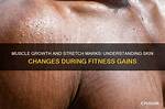 Understanding Stretch Marks and Muscle Growth: a Comprehensive Guide