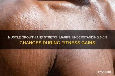 Understanding Stretch Marks and Muscle Growth: a Comprehensive Guide