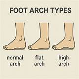 Understanding the Benefits and Features of Arch Support Slides
