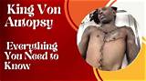 Understanding the Impact of King Von Autopsy: a Detailed Exploration