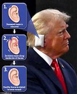 Understanding the Importance of Trump Shooting Ear Protection