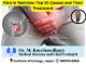 Understanding the Value of Testicles: an Unconventional Exploration