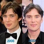 Unmasking the Rumors Surrounding Cillian Murphy's Health