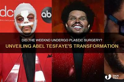 Unveiling Abel Tesfaye's Ethnicity: a Comprehensive Exploration