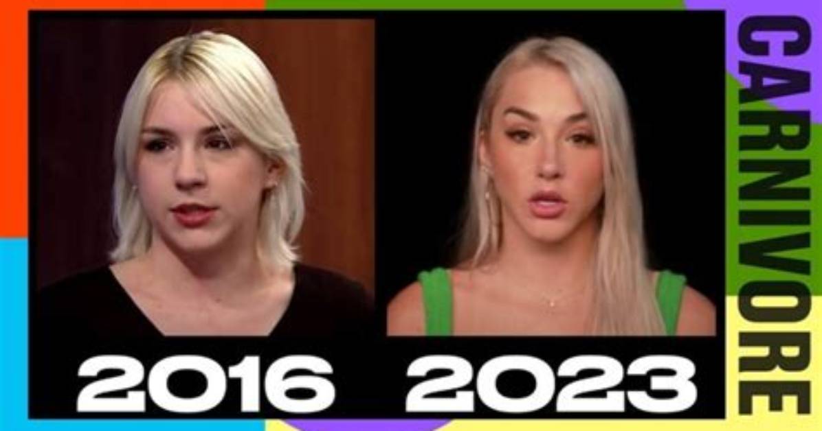 Unveiling Mikhaila Peterson's Plastic Surgery Journey: Discoveries and Insights
