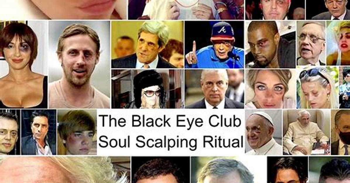 Unveiling the Black Eye Theory: a Comprehensive Exploration