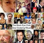 Unveiling the Black Eye Theory: a Comprehensive Exploration