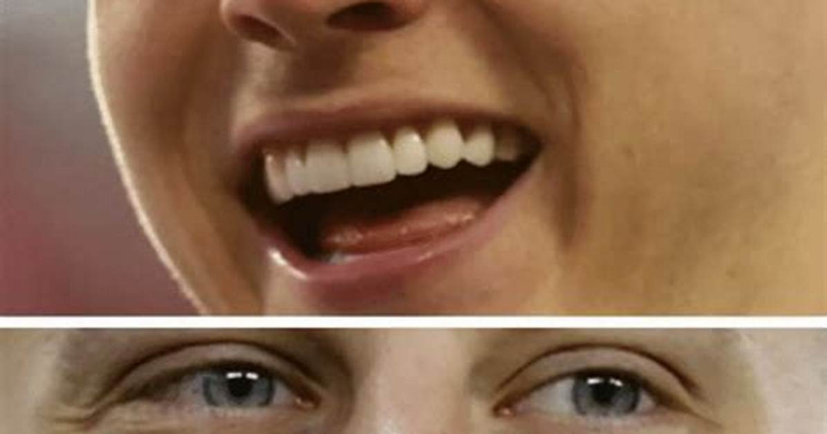 Unveiling the Truth: Joe Burrow's Veneers Journey