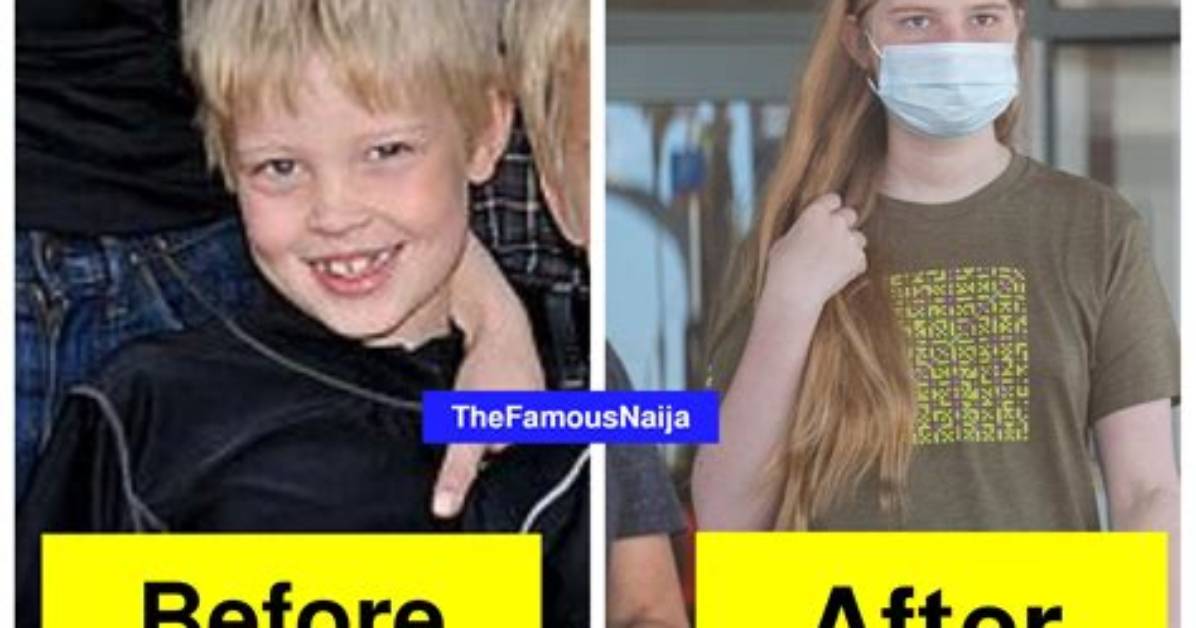 Vivian Jenna Wilson Photos Before and After Surgery on Instagram