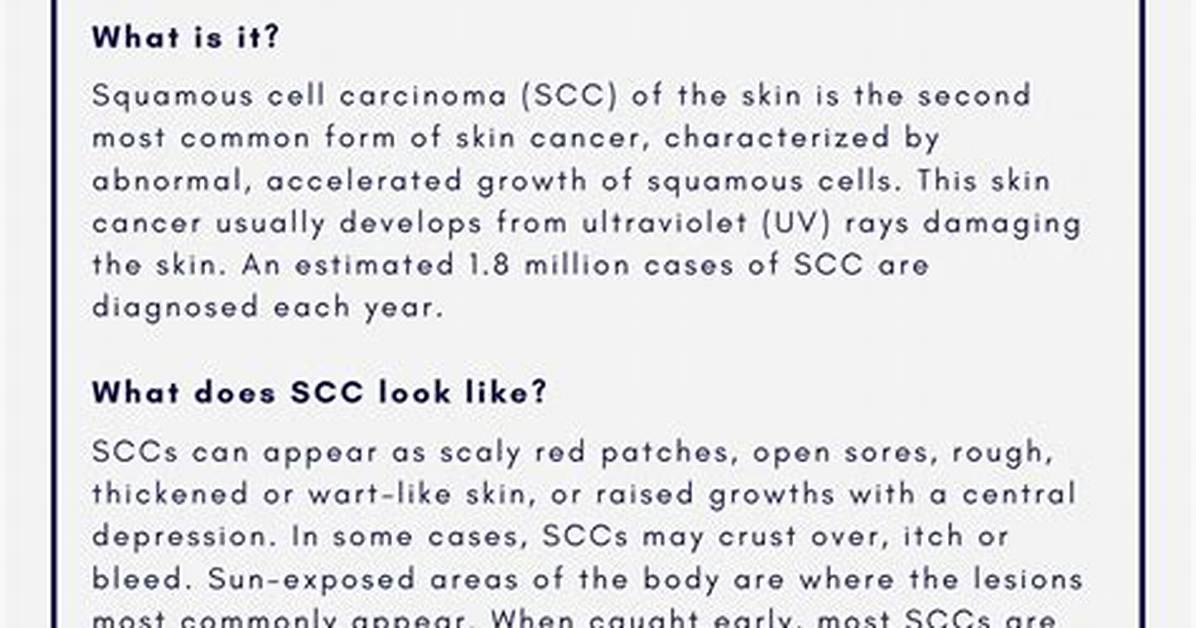 What Age Does Szs Most Commonly Appear?