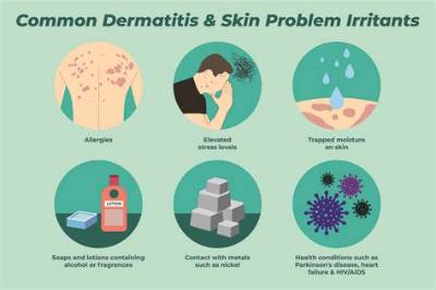 What Are Common Skin Irritants?