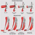 What Are Fenestrations - Lisbd-Net. Com