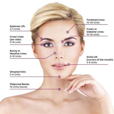 What Are the 4 Areas of Botox?